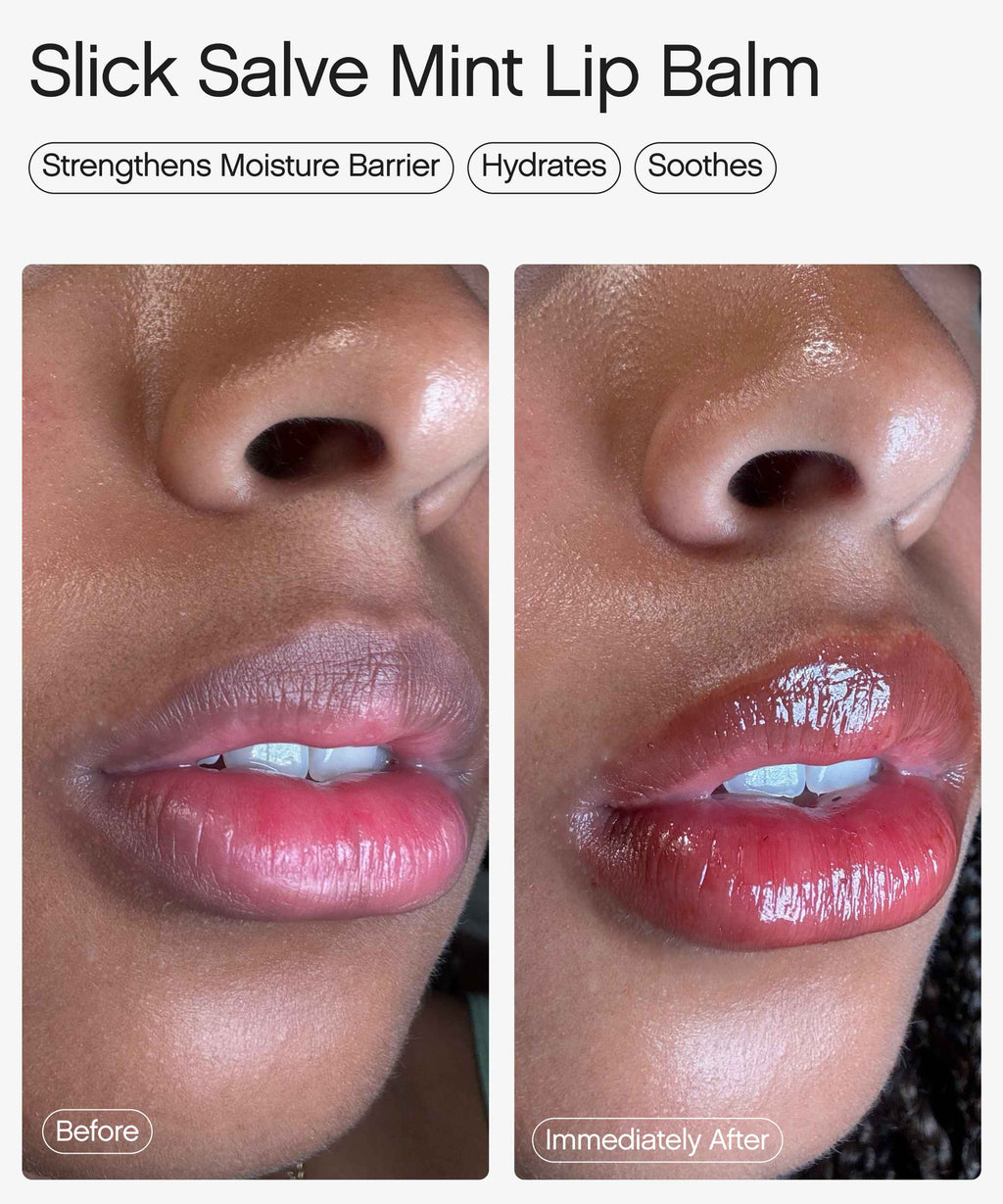 best hydrating lip balm